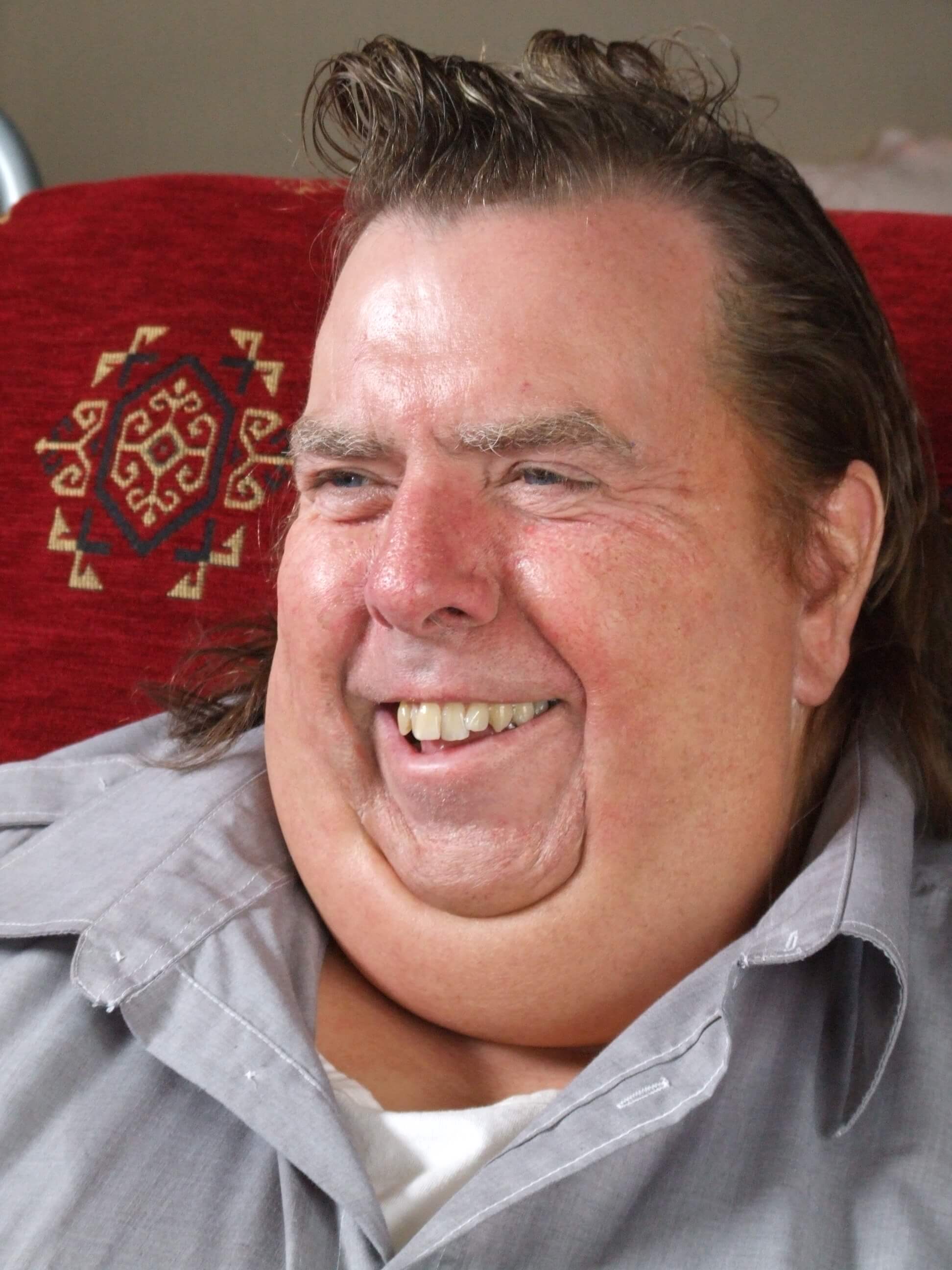 BRITAIN’S FATTEST MAN Makeup SFX